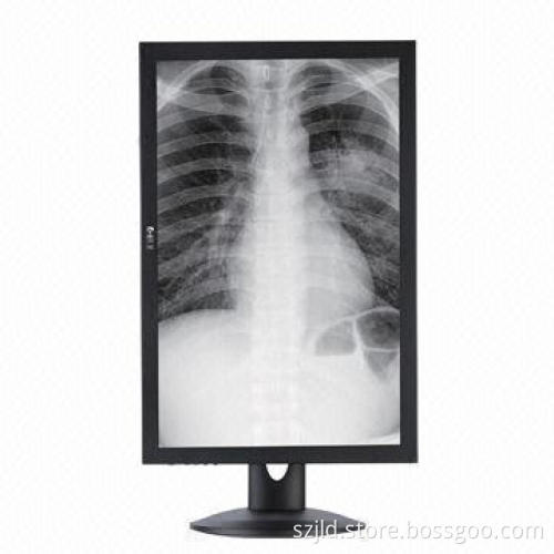 24-inch Medical Monitor, EPA, VESA Energy-saving, 24V DC Input Voltage